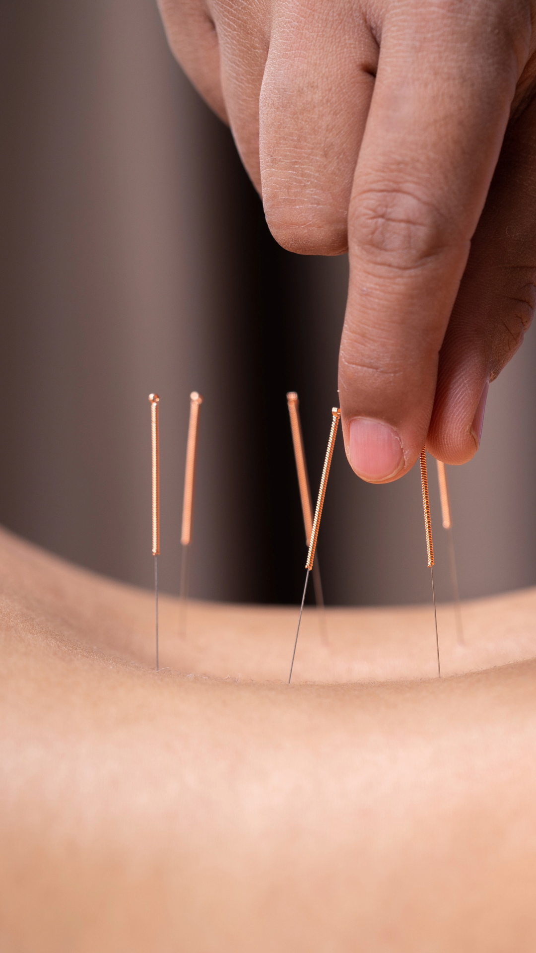 Seattle Acupuncture & Holistic Health